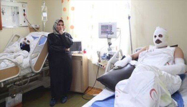 Gaz kaçağını çakmakla kontrol etti: Bu hale geldi